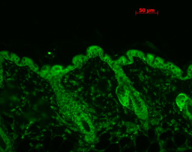 HSP90 Antibody in Immunohistochemistry (Paraffin) (IHC (P))