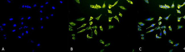 HSC70 Antibody in Immunocytochemistry (ICC/IF)