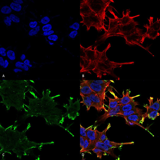 CRYAB Antibody in Immunocytochemistry (ICC/IF)