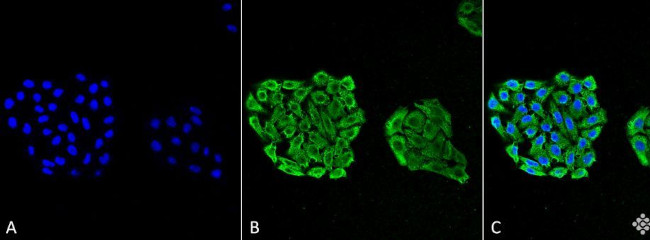 HSP70 Antibody in Immunocytochemistry (ICC/IF)