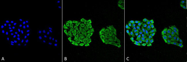 HSP70 Antibody in Immunocytochemistry (ICC/IF)