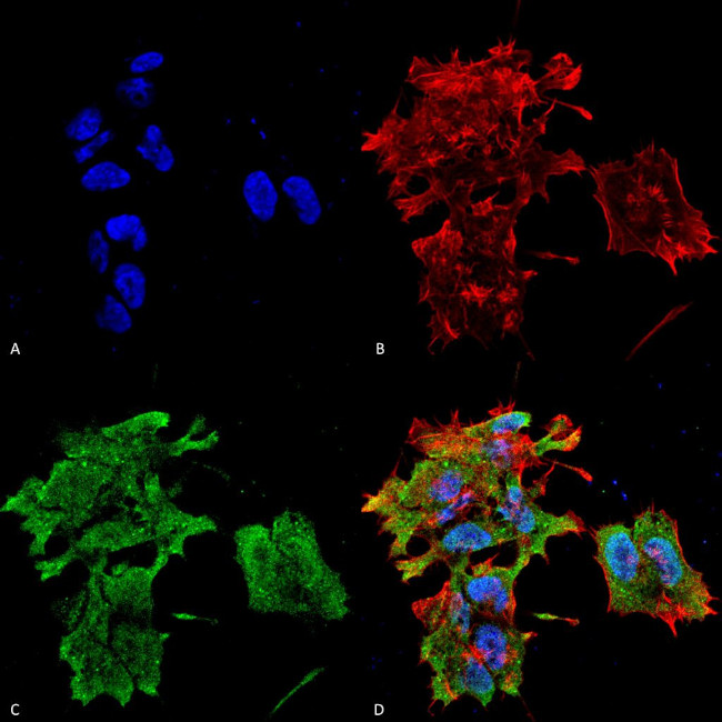 CRYAB Antibody in Immunocytochemistry (ICC/IF)