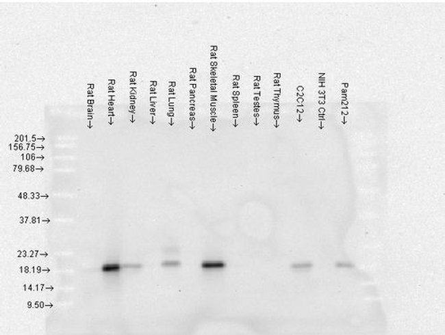 CRYAB Antibody in Western Blot (WB)