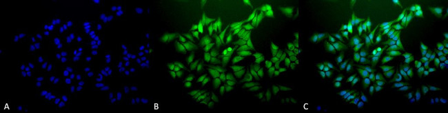 Ubiquitin Antibody in Immunocytochemistry (ICC/IF)