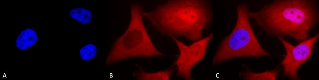 Ubiquitin Antibody in Immunocytochemistry (ICC/IF)