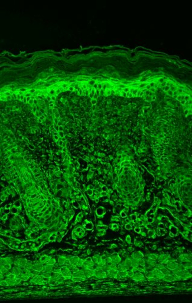 HIF-1 alpha Antibody in Immunohistochemistry (Paraffin) (IHC (P))