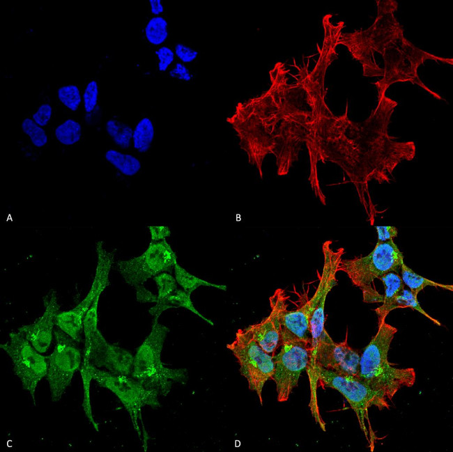 PCLO Antibody in Immunocytochemistry (ICC/IF)