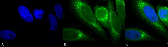 GRP78 Antibody in Immunocytochemistry (ICC/IF)