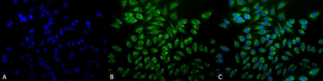 GRP78 Antibody in Immunocytochemistry (ICC/IF)