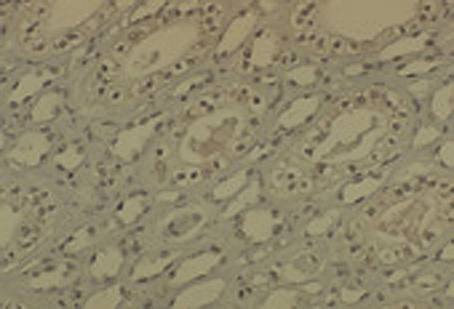 DNMT1 Antibody in Immunohistochemistry (IHC)