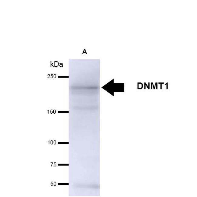 DNMT1 Antibody in Western Blot (WB)