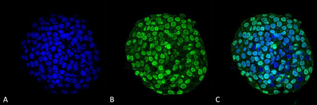 CENPA Antibody in Immunocytochemistry (ICC/IF)