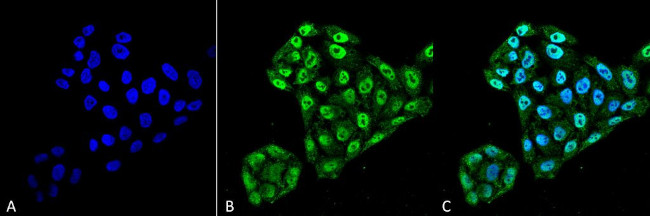 TXNDC5 Antibody in Immunocytochemistry (ICC/IF)