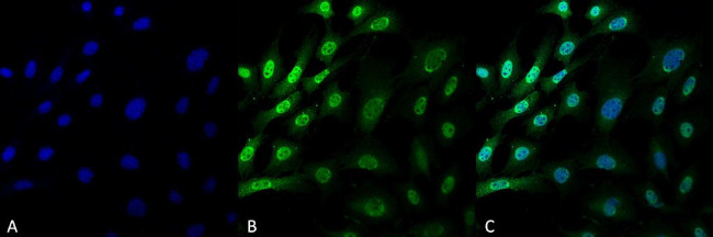 Ubiquitin Antibody in Immunocytochemistry (ICC/IF)