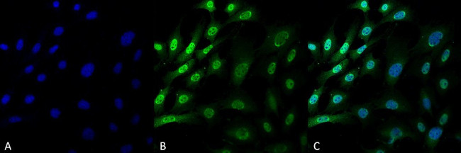 Ubiquitin Antibody in Immunocytochemistry (ICC/IF)