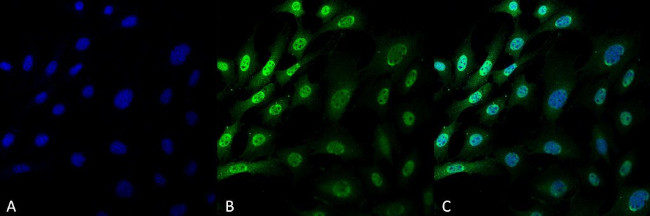 Ubiquitin Antibody in Immunocytochemistry (ICC/IF)