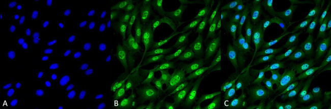 Ubiquitin Antibody in Immunocytochemistry (ICC/IF)