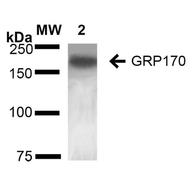 HYOU1 Antibody in Western Blot (WB)