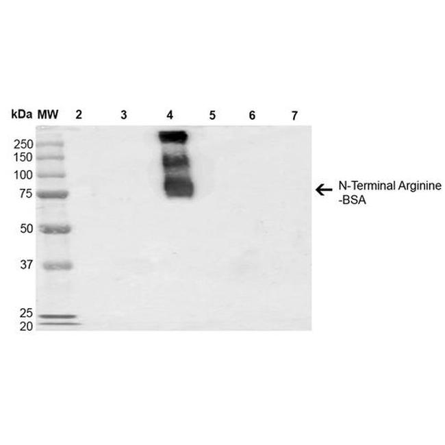 N-terminal Arginylation Antibody in Western Blot (WB)