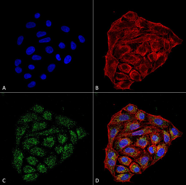 CD74 Antibody in Immunocytochemistry (ICC/IF)