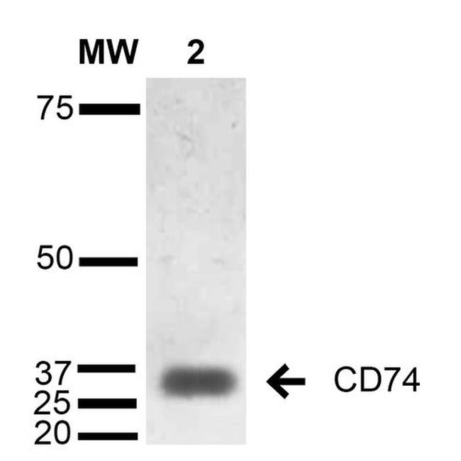 CD74 Antibody in Western Blot (WB)