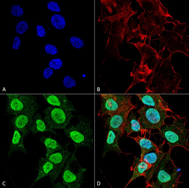 CaV1.2 Antibody in Immunocytochemistry (ICC/IF)