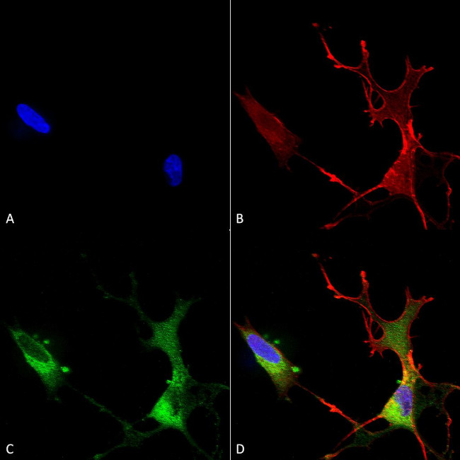 CaV1.2 Antibody in Immunocytochemistry (ICC/IF)