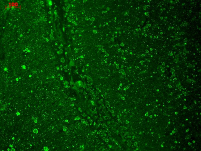 CaV1.2 Antibody in Immunohistochemistry (PFA fixed) (IHC (PFA))