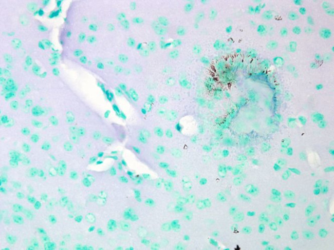 CaV1.2 Antibody in Immunohistochemistry (PFA fixed) (IHC (PFA))