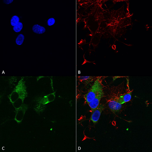 CaV1.3 Antibody in Immunocytochemistry (ICC/IF)