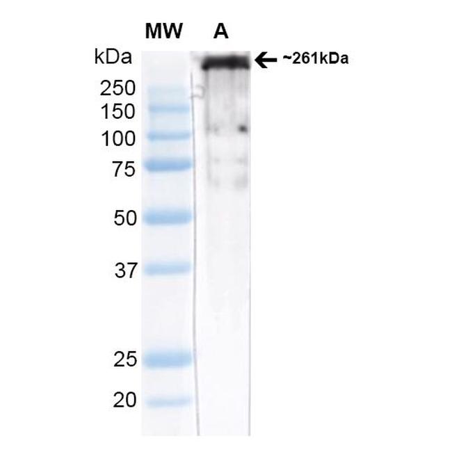 CaV3.2 Antibody in Western Blot (WB)