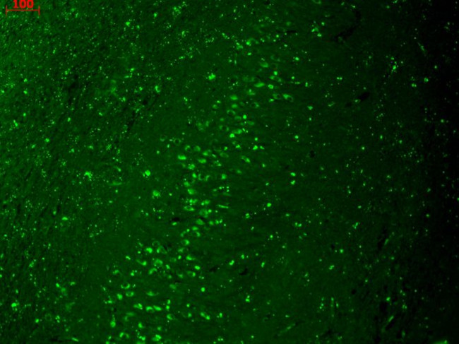 Kir2.1 (KCNJ2) Antibody in Immunohistochemistry (Paraffin) (IHC (P))