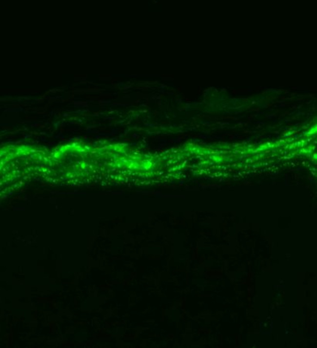 SCN9A Antibody in Immunohistochemistry (Paraffin) (IHC (P))