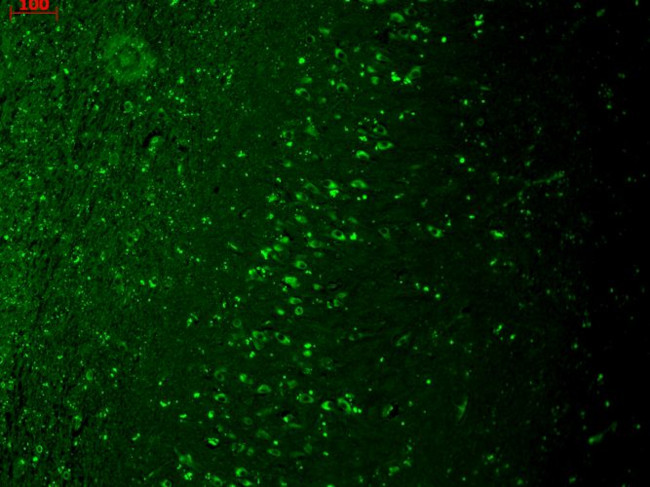 TRPM7 Antibody in Immunohistochemistry (Paraffin) (IHC (P))