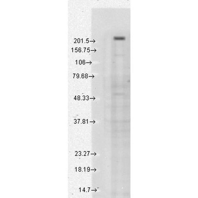 TRPM7 Antibody in Western Blot (WB)