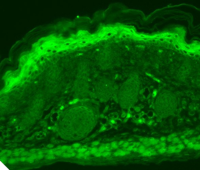 TRPV3 Antibody in Immunohistochemistry (Paraffin) (IHC (P))