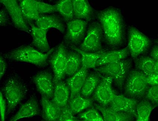 Slo2.2 Antibody in Immunocytochemistry (ICC/IF)