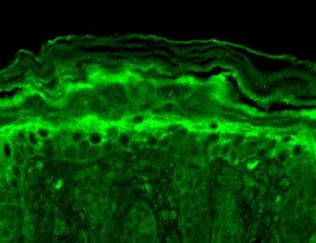 Slo2.2 Antibody in Immunohistochemistry (Paraffin) (IHC (P))