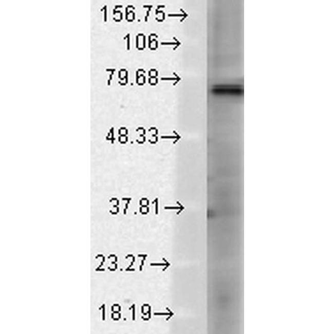 TRPV3 Antibody in Western Blot (WB)