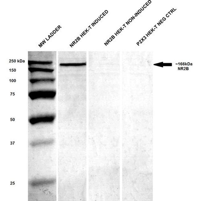 NMDAR2B Antibody in Western Blot (WB)