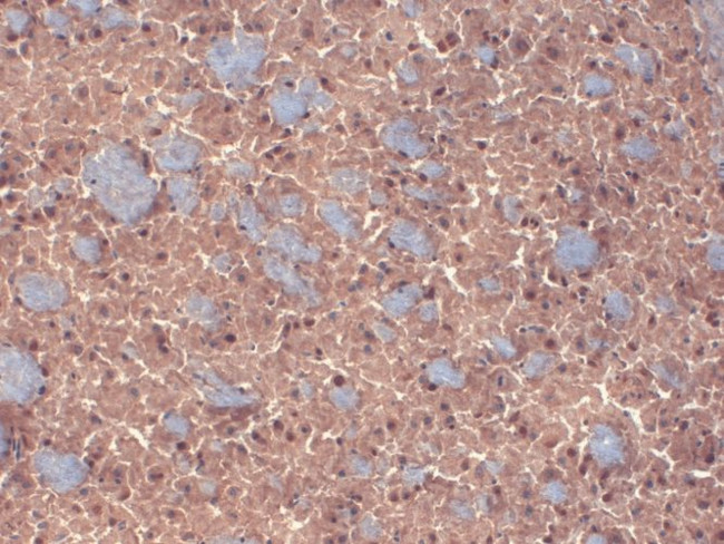 GABRB3 Antibody in Immunohistochemistry (PFA fixed) (IHC (PFA))