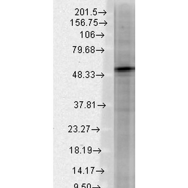 GABRB3 Antibody in Western Blot (WB)