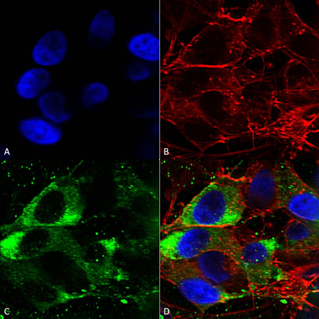 SCN10A Antibody in Immunocytochemistry (ICC/IF)