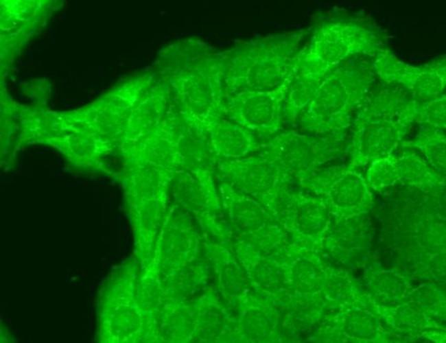 SCN10A Antibody in Immunocytochemistry (ICC/IF)