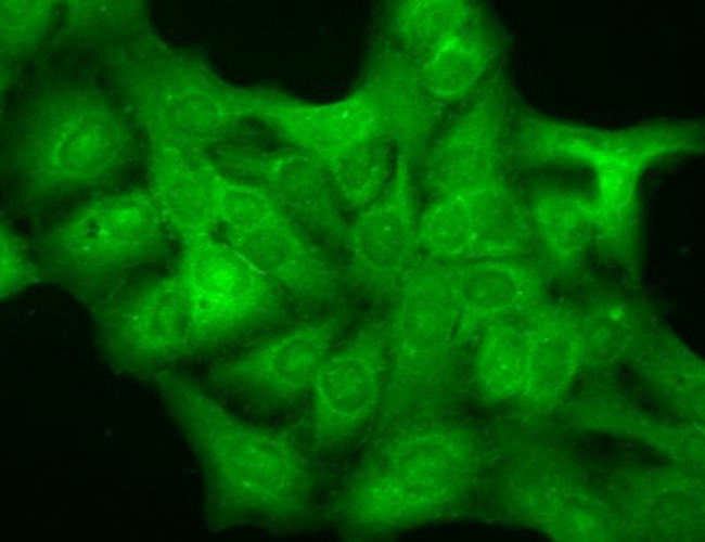 GABRD Antibody in Immunocytochemistry (ICC/IF)