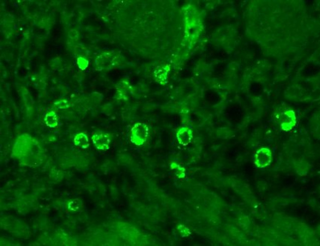 GABRA1 Antibody in Immunohistochemistry (Paraffin) (IHC (P))