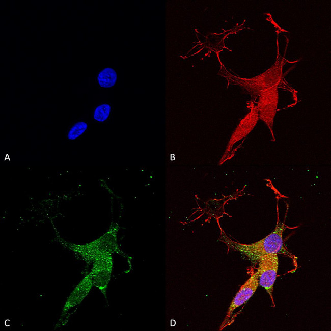 VGLUT3 Antibody in Immunocytochemistry (ICC/IF)