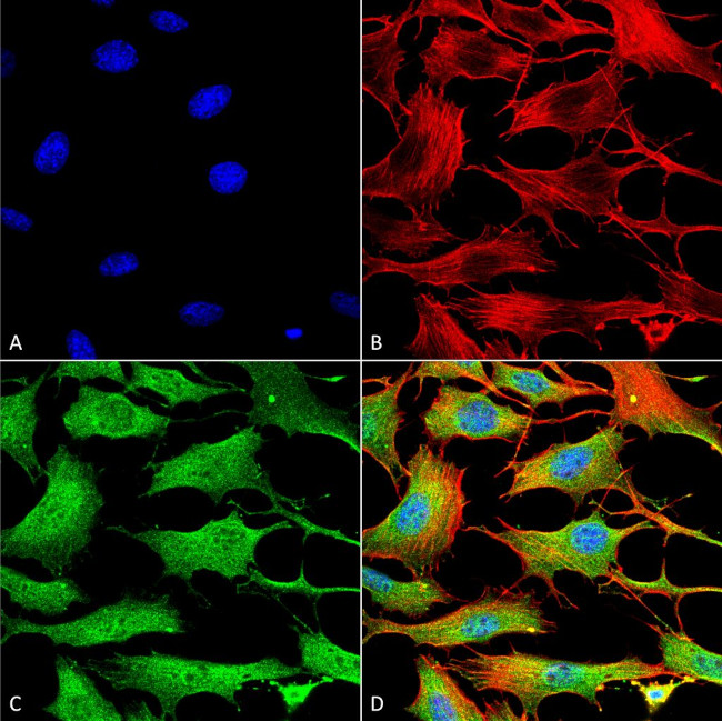 ATP7B Antibody in Immunocytochemistry (ICC/IF)