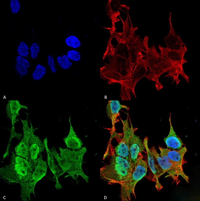 Ankyrin B Antibody in Immunocytochemistry (ICC/IF)