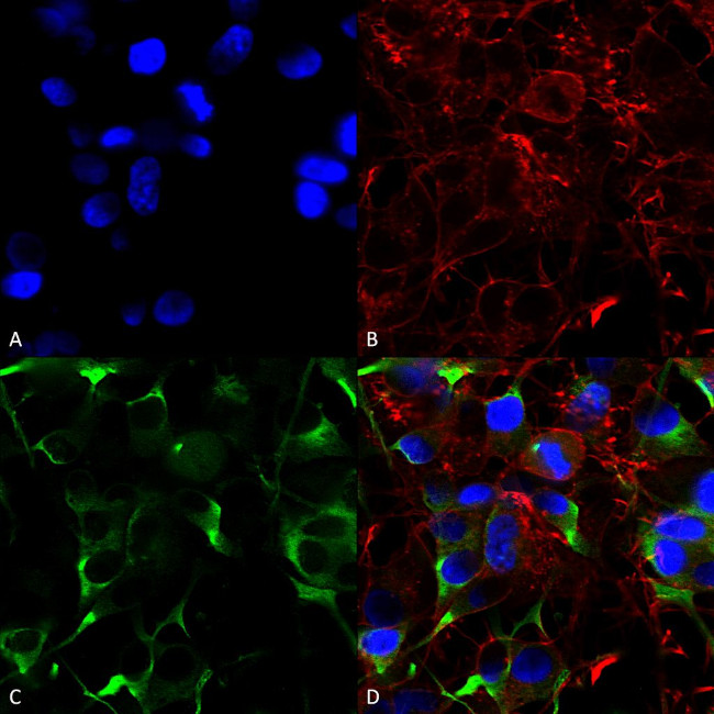 SLC38A1 Antibody in Immunocytochemistry (ICC/IF)